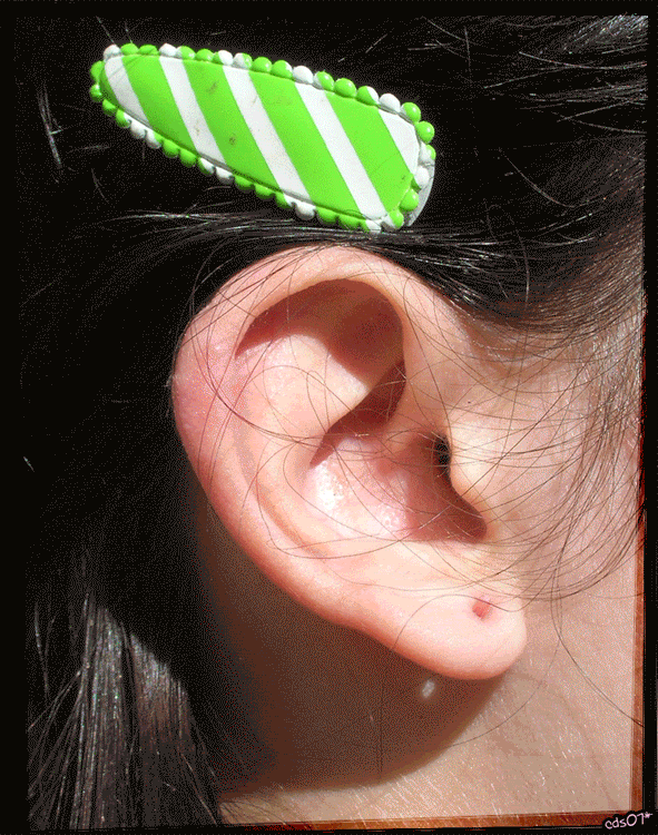 expansores expansores